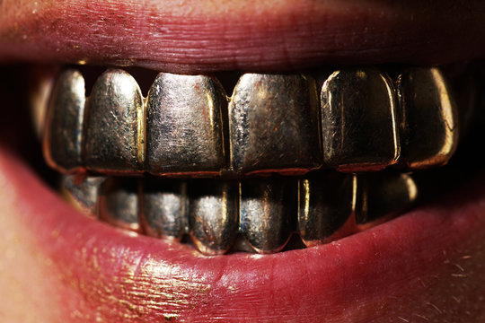 Gold teeth images â browse photos vectors and video