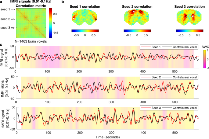 Intrinsic macroscale oscillatory modes driving long range functional connectivity in female rat brains detected by ultrafast fmri munications