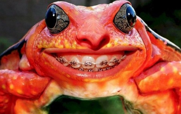 Frog Teeth Braces (click to view)